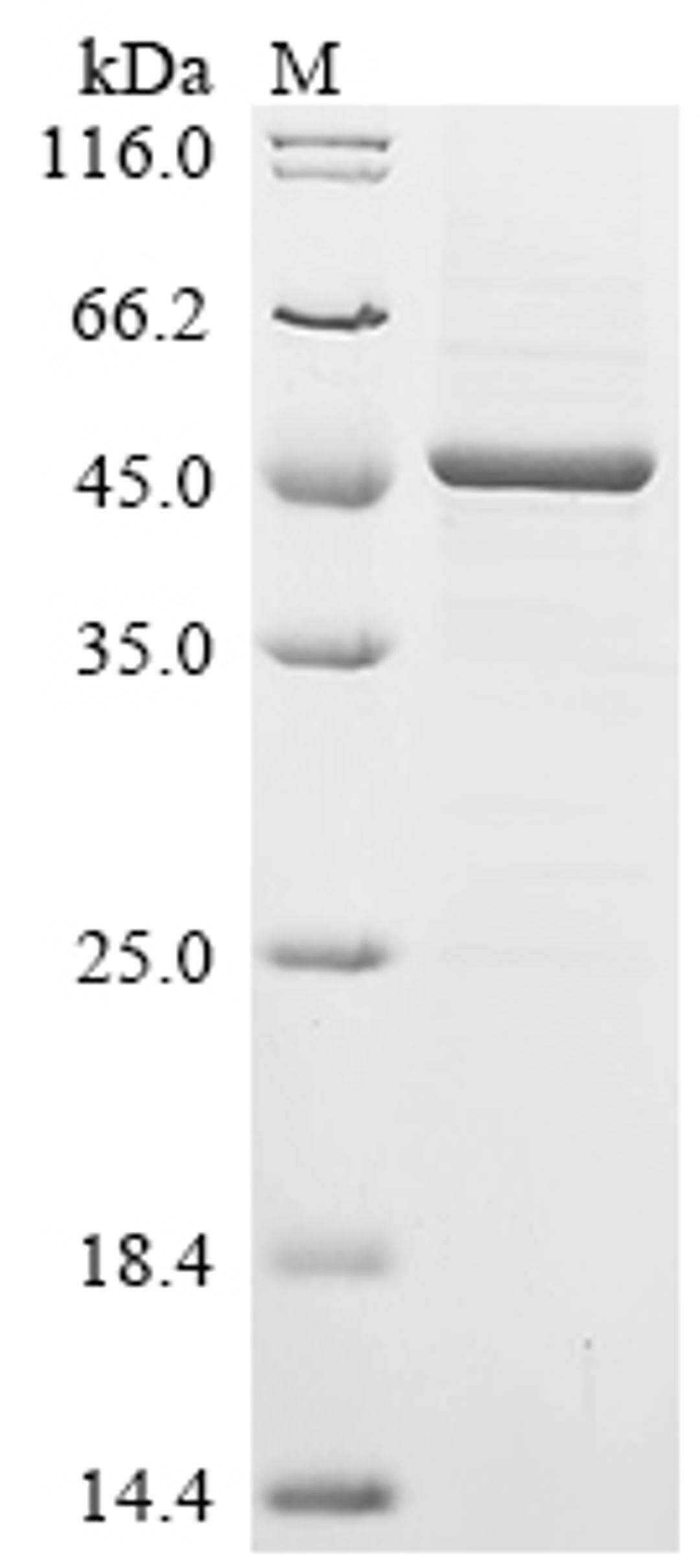 (Tris-Glycine gel) Discontinuous SDS-PAGE (reduced) with 5% enrichment gel and 15% separation gel.