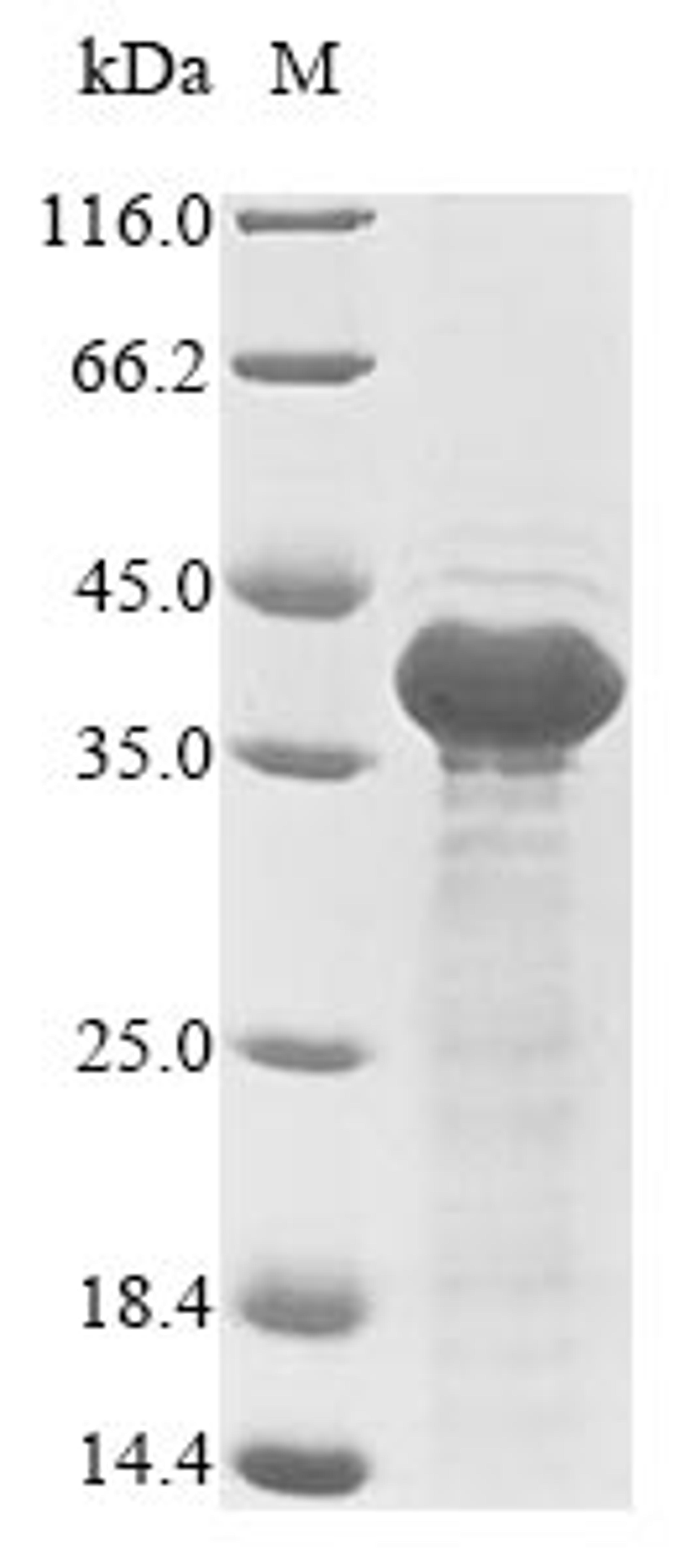 (Tris-Glycine gel) Discontinuous SDS-PAGE (reduced) with 5% enrichment gel and 15% separation gel.