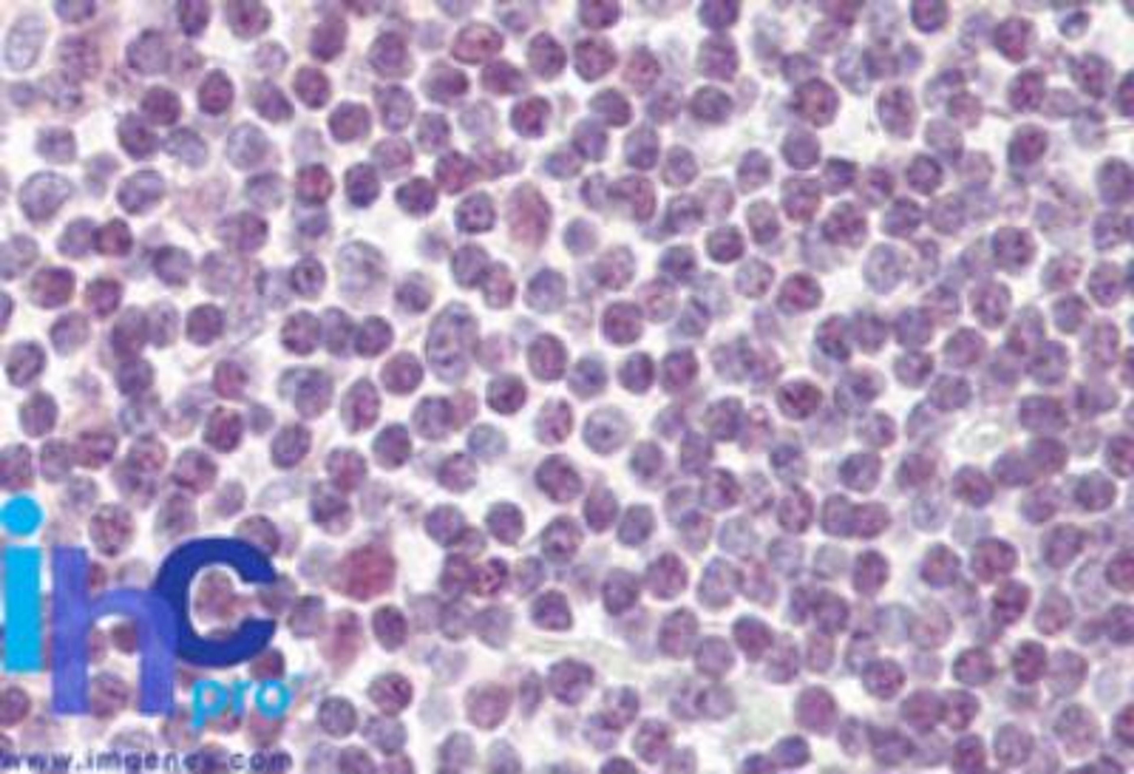 Immunohistochemistry-Paraffin: DDX18 Antibody [NBP2-27353] - Formalin-fixed, paraffin-embedded human tonsil stained with DDX18 antibody at 10 ug/ml.