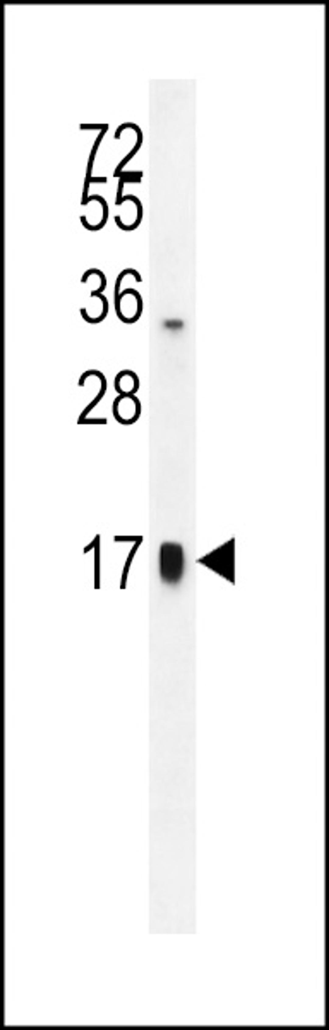 Western blot analysis in HepG2 cell line lysates (35ug/lane).