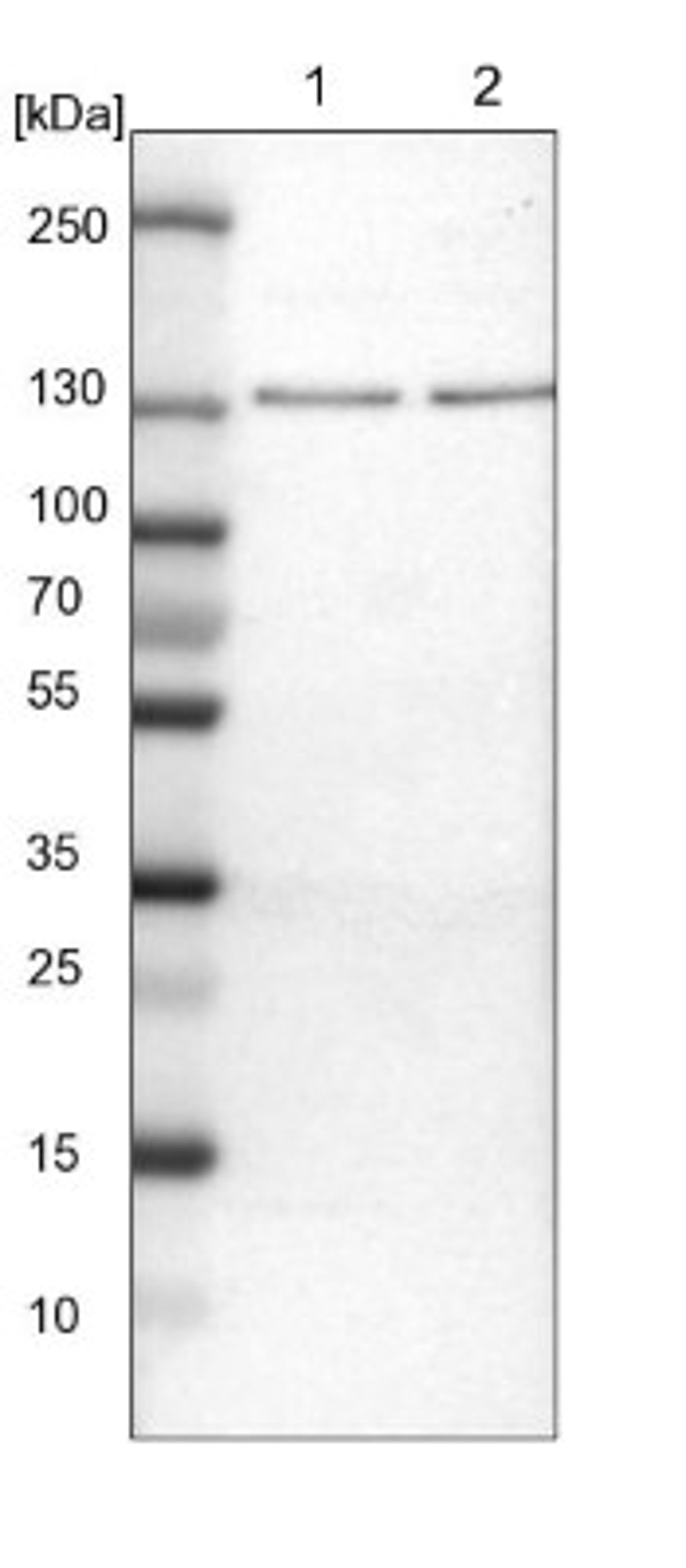 Western Blot: FAM62A Antibody [NBP1-84741] - Lane 1: NIH-3T3 cell lysate (Mouse embryonic fibroblast cells)<br/>Lane 2: NBT-II cell lysate (Rat Wistar bladder tumour cells)