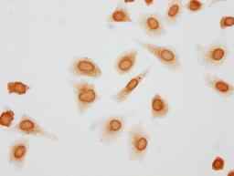 Immunocytochemistry analysis of CSB-PA010379OA146phHU diluted at 1:10 and staining in Hela cells(treated with 50nM Calyculin A for 30min) performed on a Leica BondTM system. The cells were fixed in 4% formaldehyde, permeabilized using 0.2% Triton X-100 and blocked with 10% normal goat serum 30min at RT. Then primary antibody (1% BSA) was incubated at 4°C overnight. The primary is detected by a biotinylated secondary antibody and visualized using an HRP conjugated SP system.