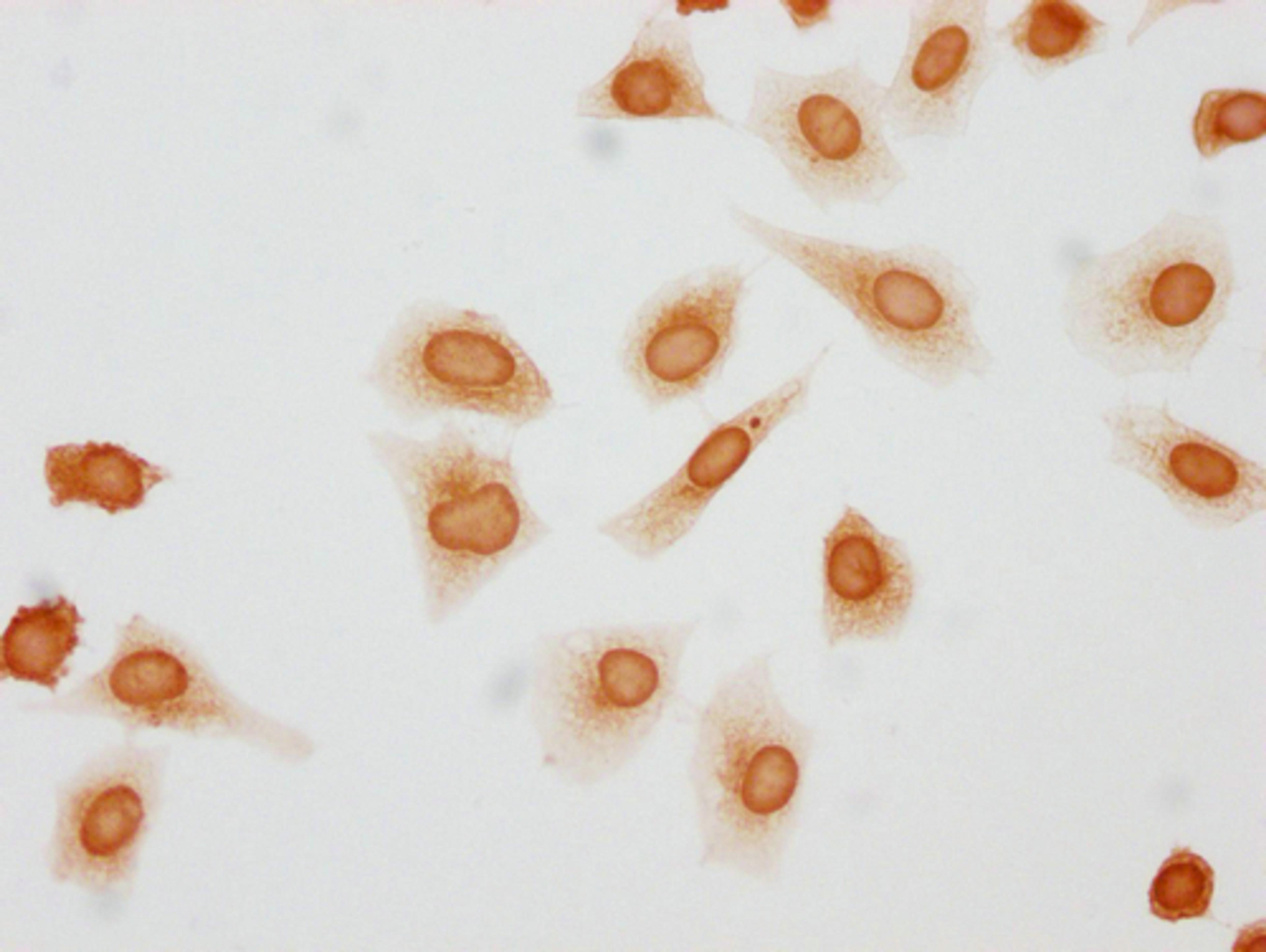 Immunocytochemistry analysis of CSB-PA010379OA146phHU diluted at 1:10 and staining in Hela cells(treated with 50nM Calyculin A for 30min) performed on a Leica BondTM system. The cells were fixed in 4% formaldehyde, permeabilized using 0.2% Triton X-100 and blocked with 10% normal goat serum 30min at RT. Then primary antibody (1% BSA) was incubated at 4°C overnight. The primary is detected by a biotinylated secondary antibody and visualized using an HRP conjugated SP system.