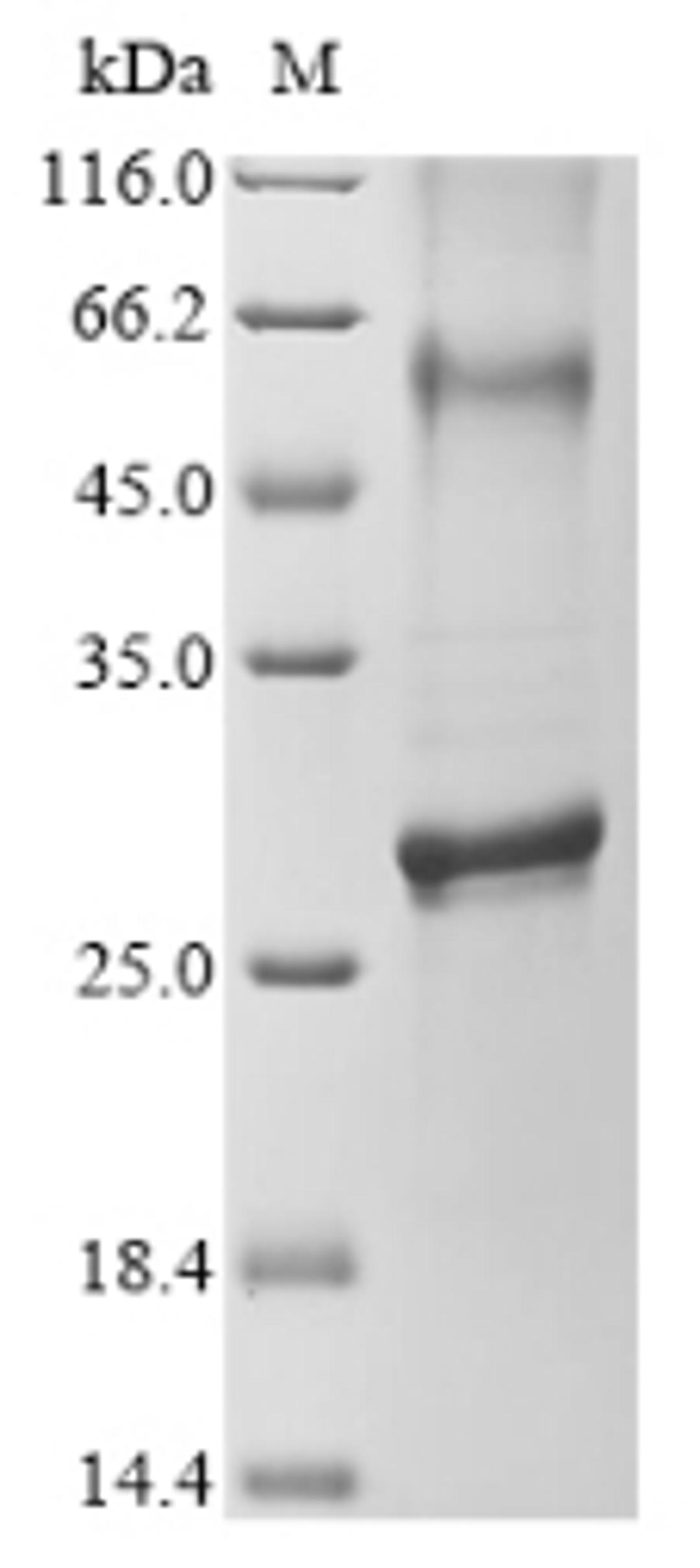 (Tris-Glycine gel) Discontinuous SDS-PAGE (reduced) with 5% enrichment gel and 15% separation gel.