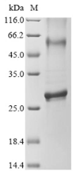 (Tris-Glycine gel) Discontinuous SDS-PAGE (reduced) with 5% enrichment gel and 15% separation gel.