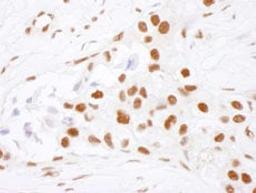 Detection of human NF90 by immunohistochemistry.