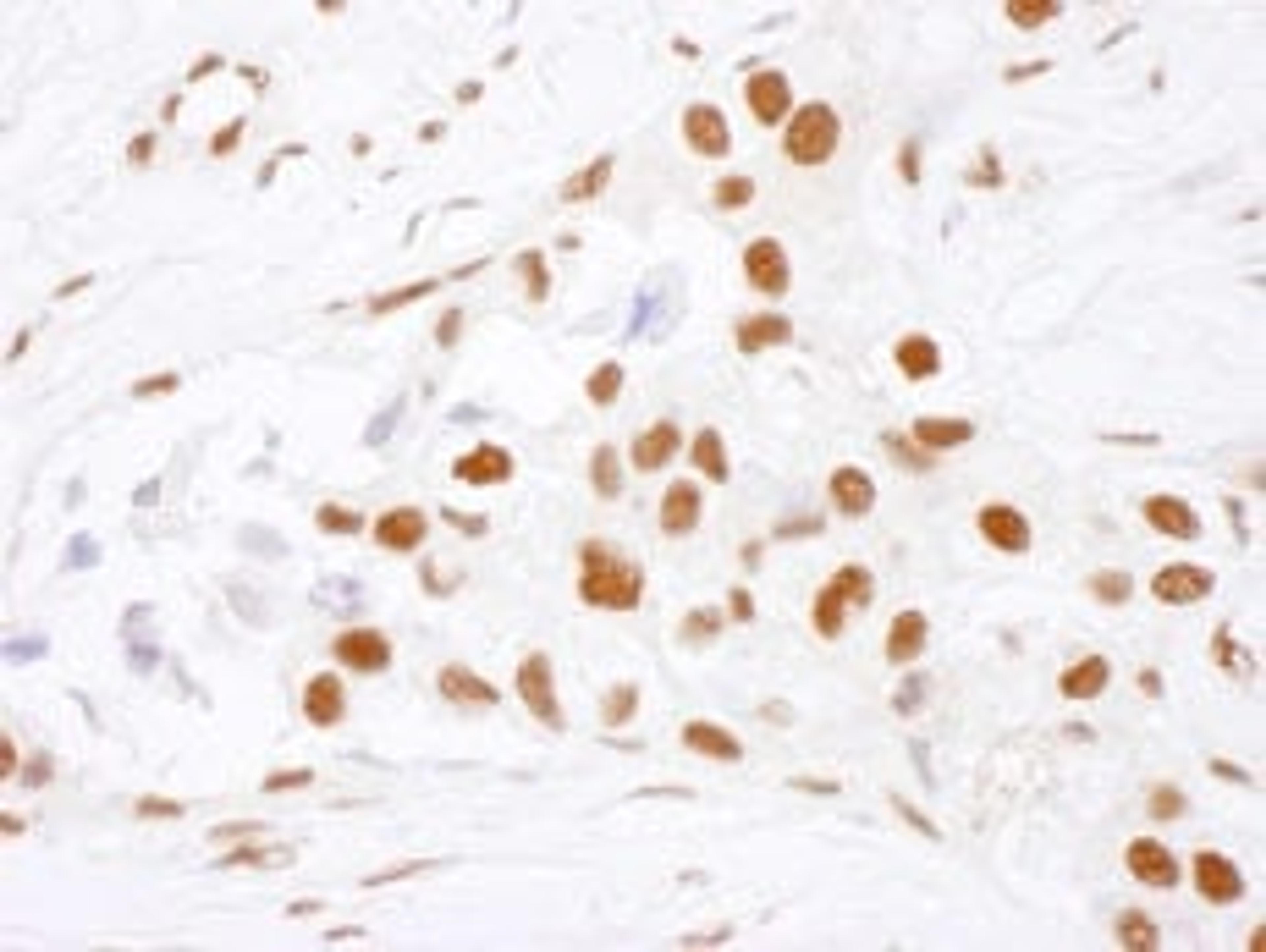 Detection of human NF90 by immunohistochemistry.