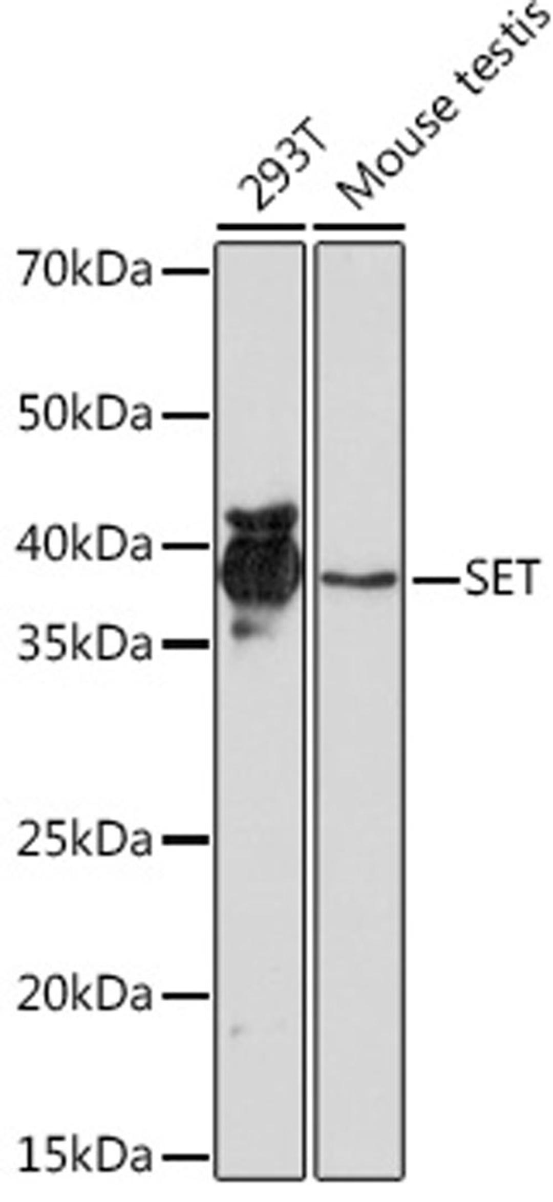 Western blot - SET Rabbit mAb (A9173)