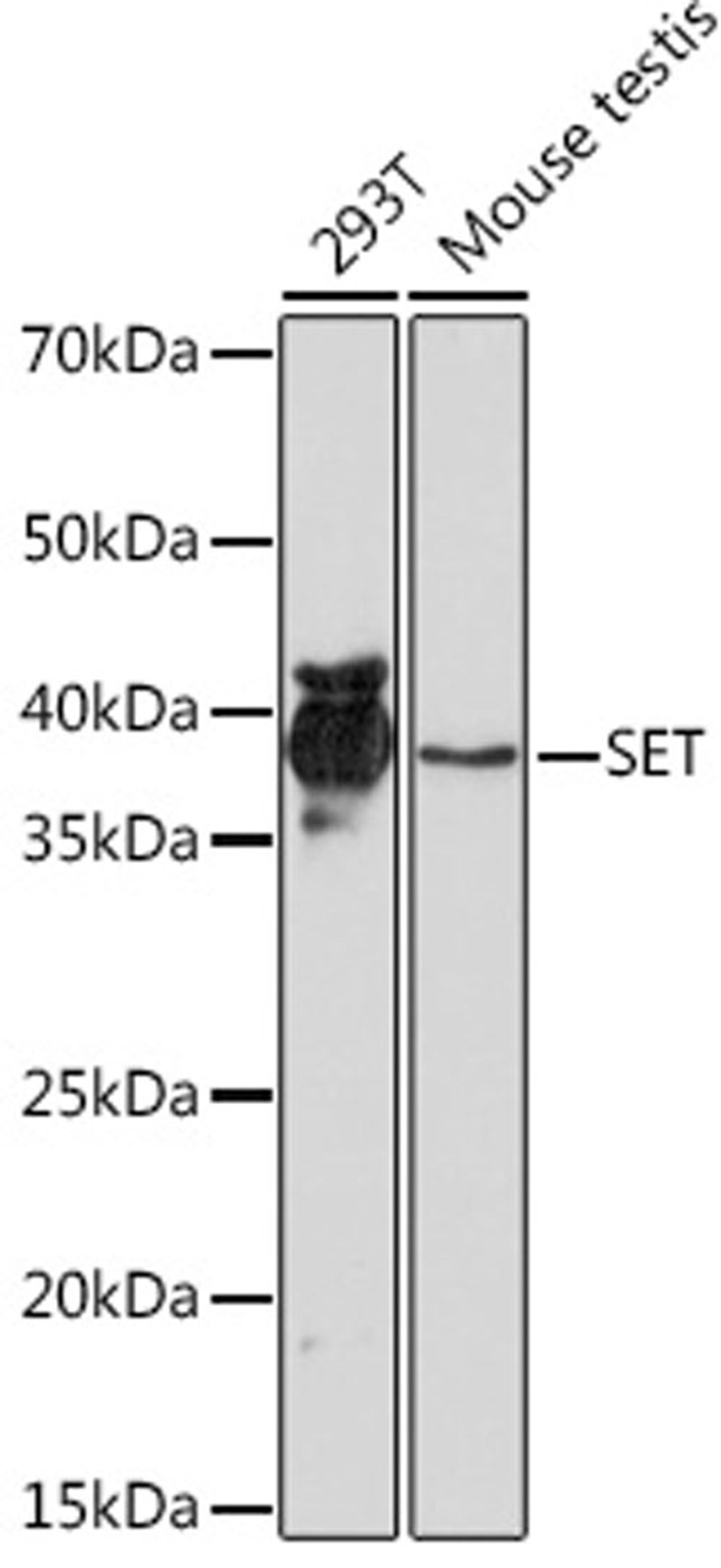 Western blot - SET Rabbit mAb (A9173)