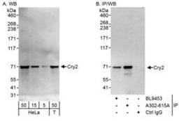 Detection of human Cry2 by western blot and immunoprecipitation.