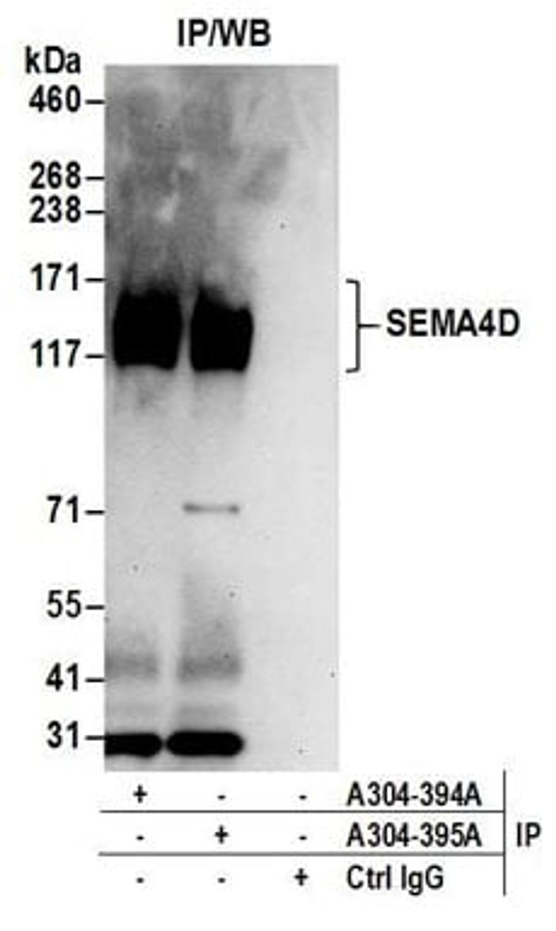 Detection of human SEMA4D by western blot of immunoprecipitates.