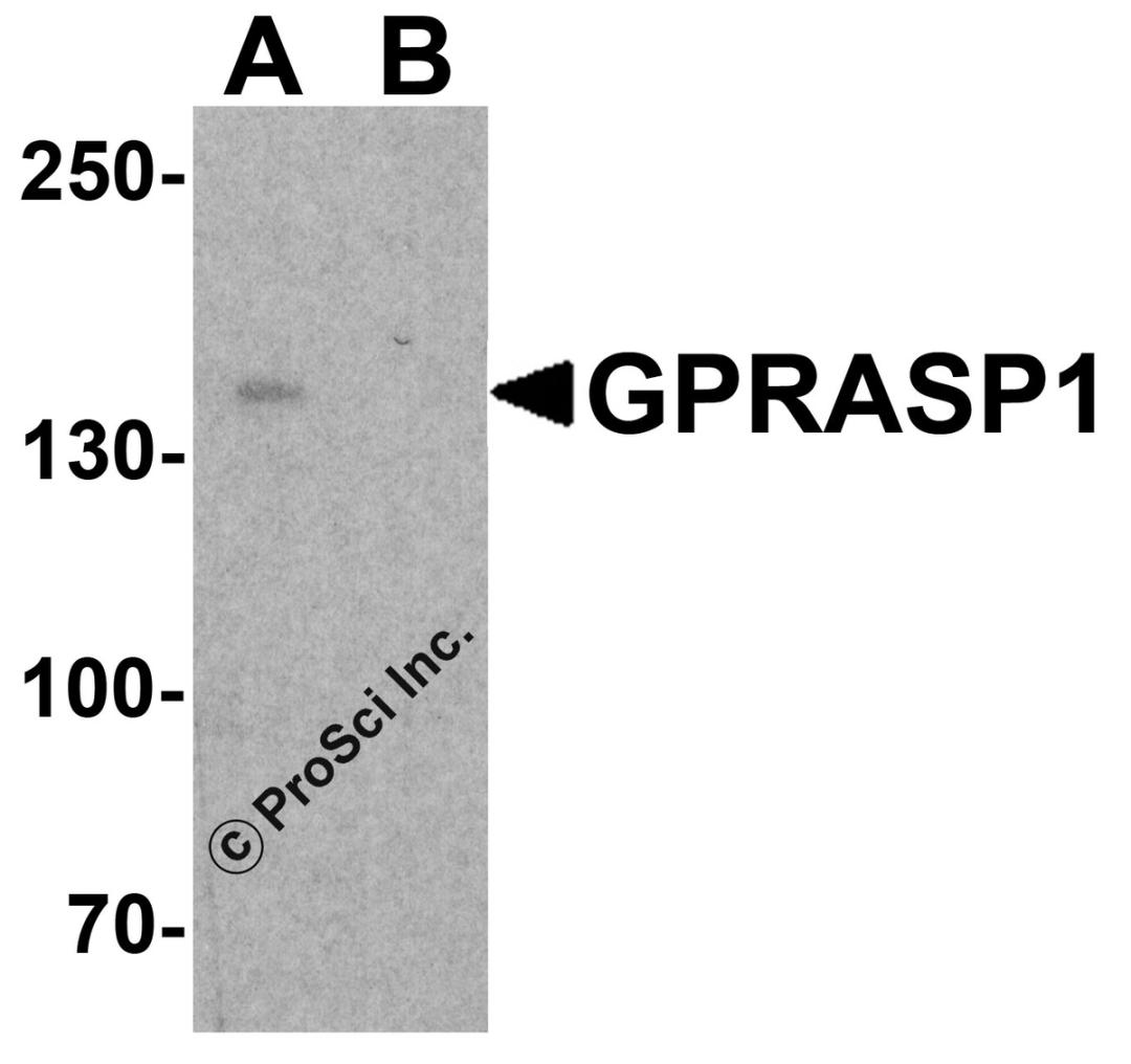 Western blot analysis of GPRASP1 in A-20 cell lysate with GPRASP1 antibody at 1 μg/ml in (A) the absence and (B) the presence of blocking peptide.