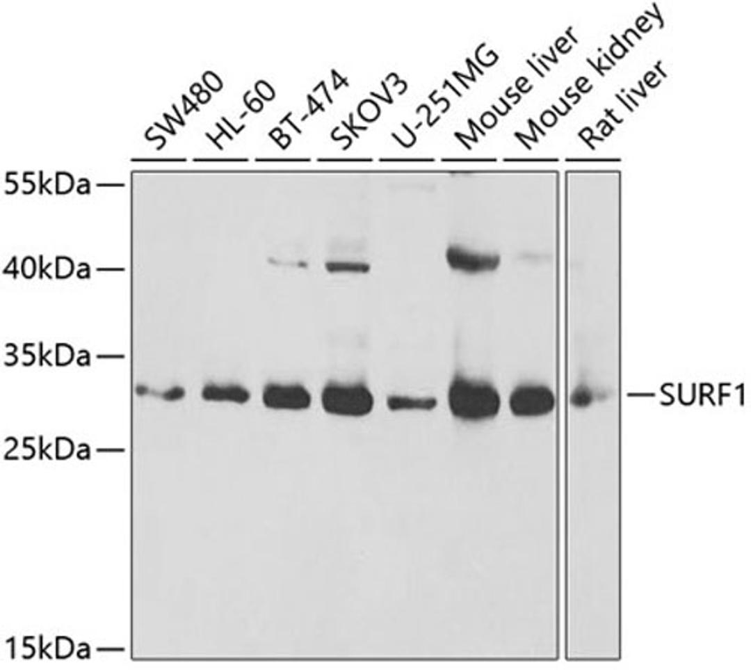 Western blot - SURF1 antibody (A6758)