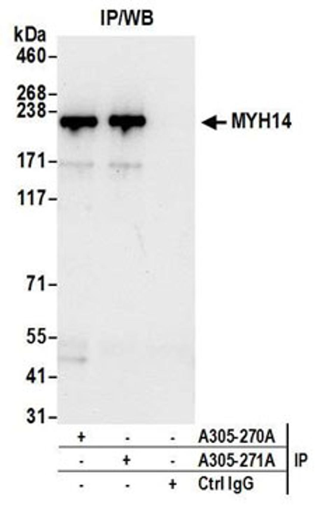 Detection of human MYH14 by western blot of immunoprecipitates.