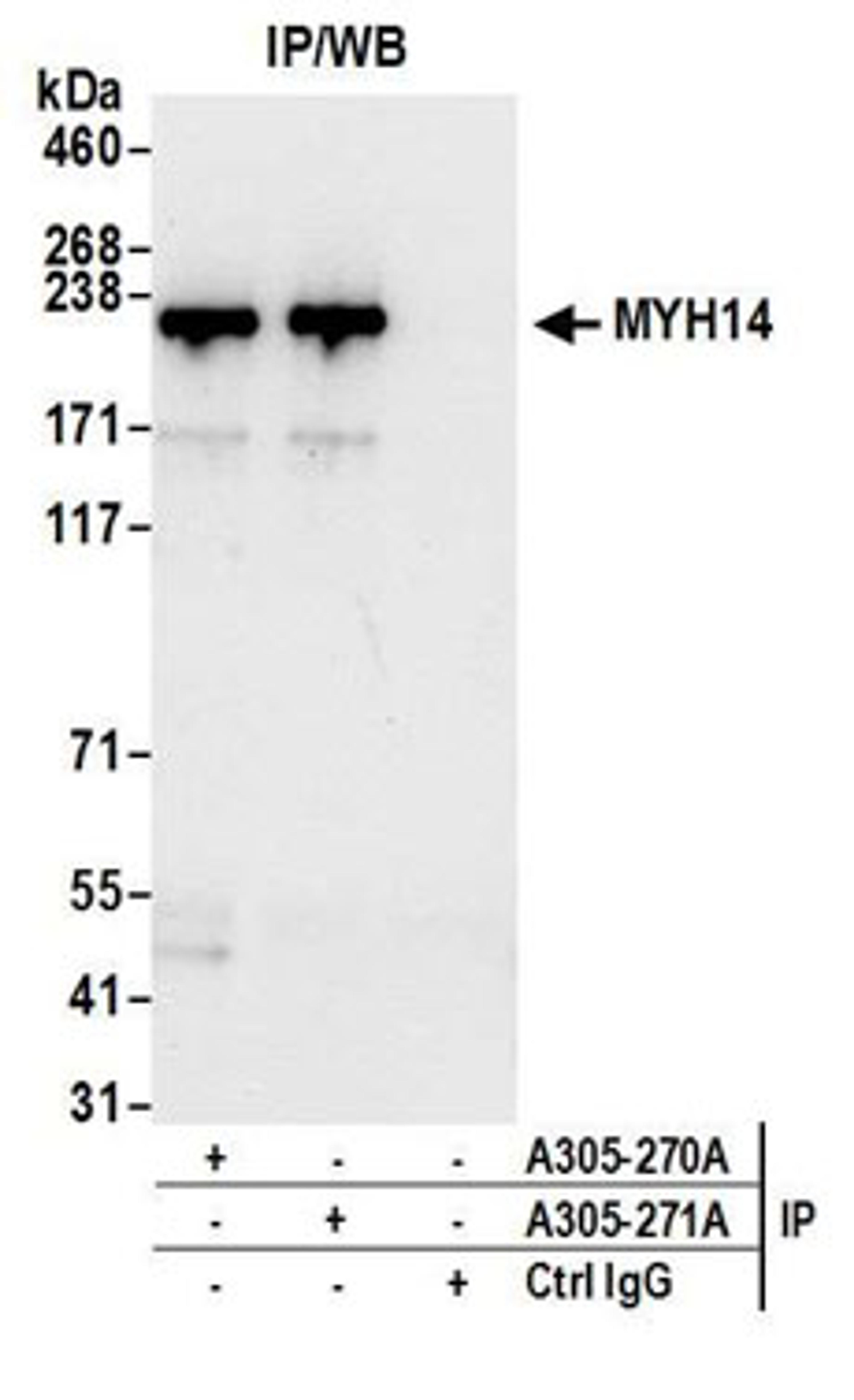 Detection of human MYH14 by western blot of immunoprecipitates.