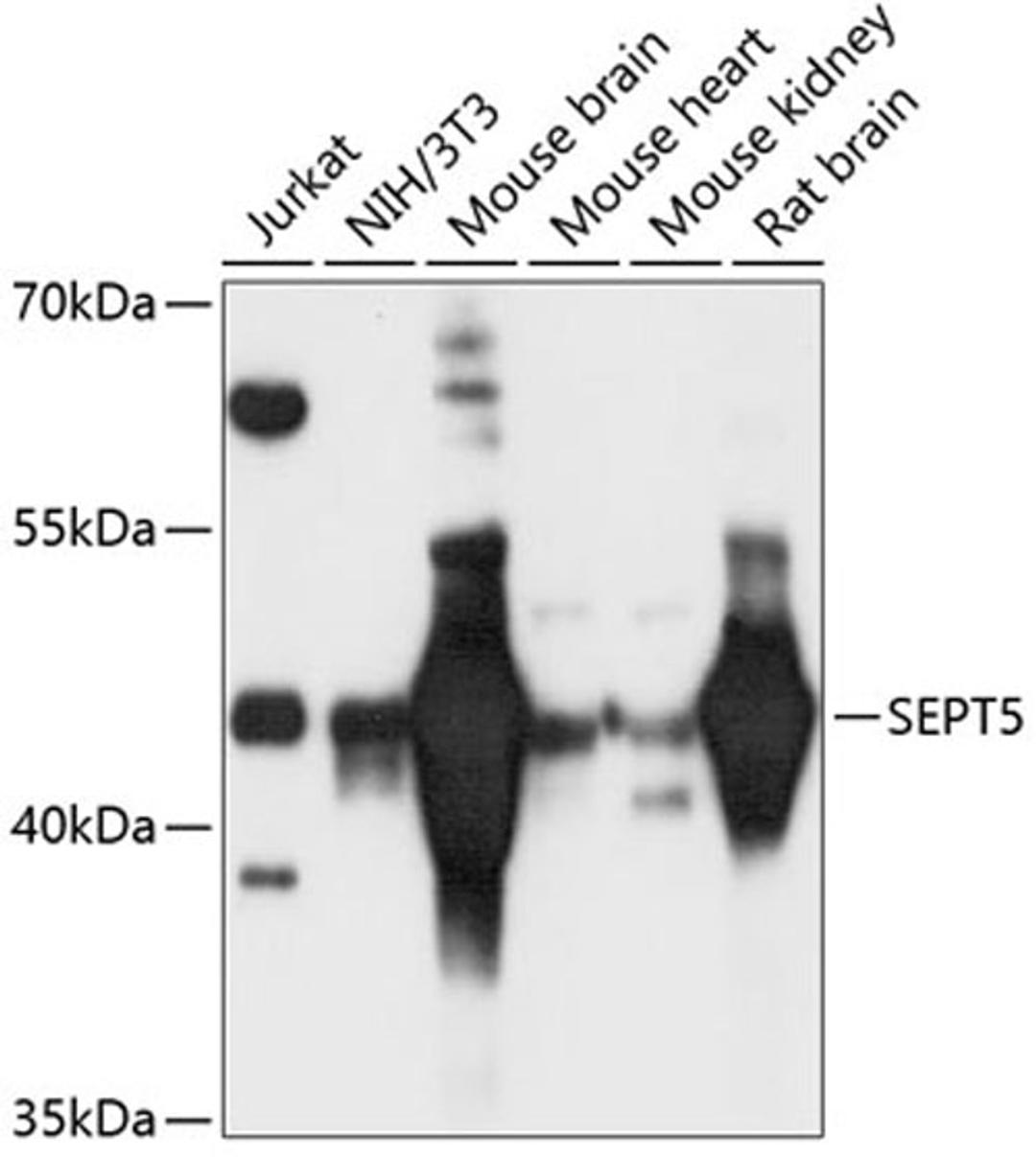 Western blot - SEPT5 antibody (A12953)