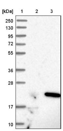 Western Blot: PFDN5 Antibody [NBP1-82639] - Lane 1: Marker [kDa] 250, 130, 95, 72, 55, 36, 28, 17, 10<br/>Lane 2: Negative control (vector only transfected HEK293T lysate)<br/>Lane 3: Over-expression lysate (Co-expressed with a C-terminal myc-DDK tag (~3.1 kDa) in mammalian HEK293T cells, LY419199)