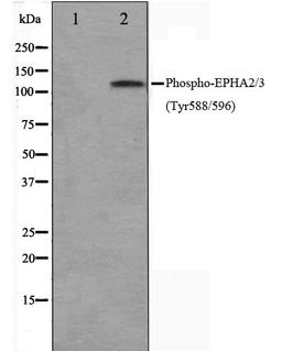 Western blot analysis of HepG2 cell lysate using EPHA2/3 (Phospho-Tyr588/596) antibody