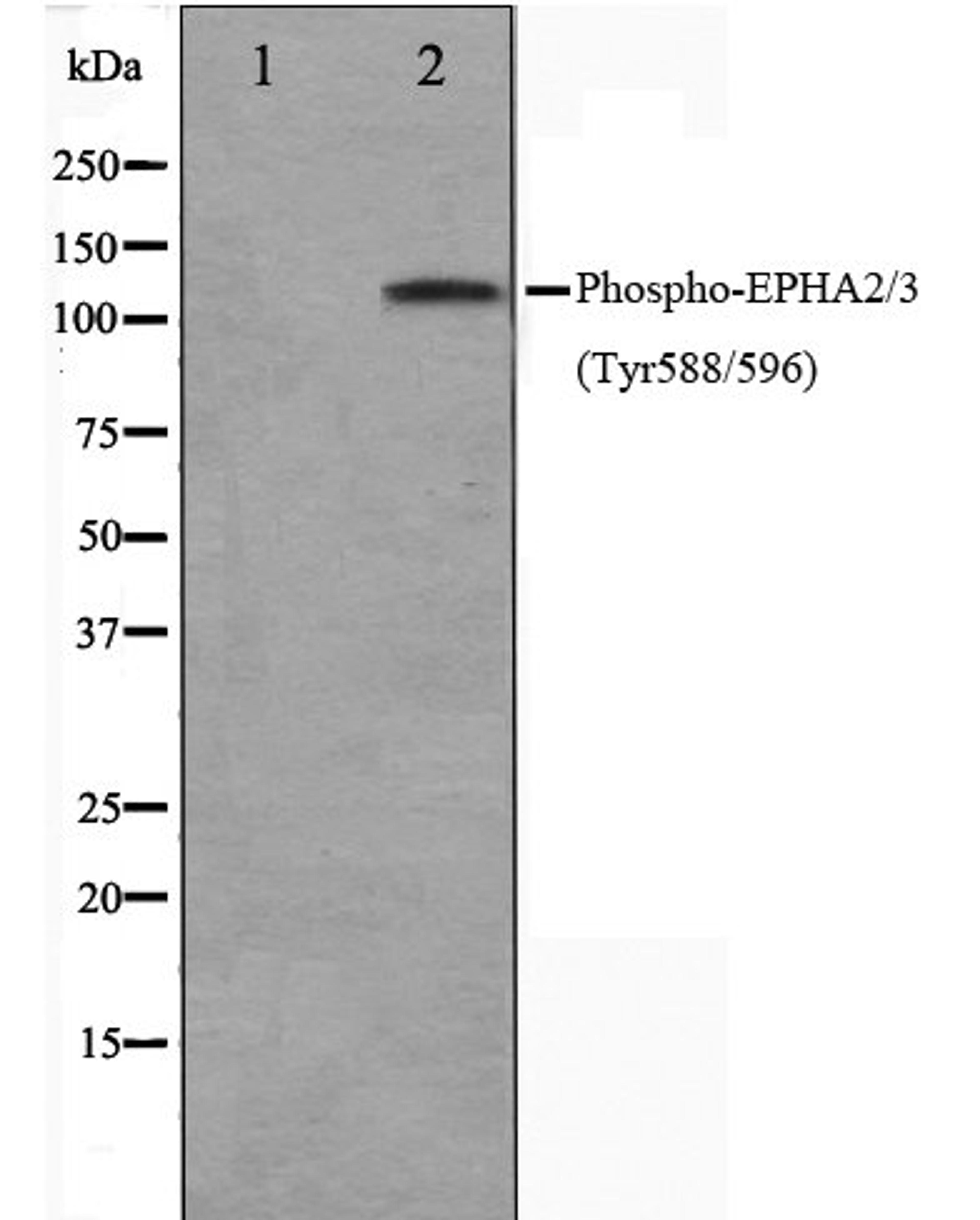 Western blot analysis of HepG2 cell lysate using EPHA2/3 (Phospho-Tyr588/596) antibody