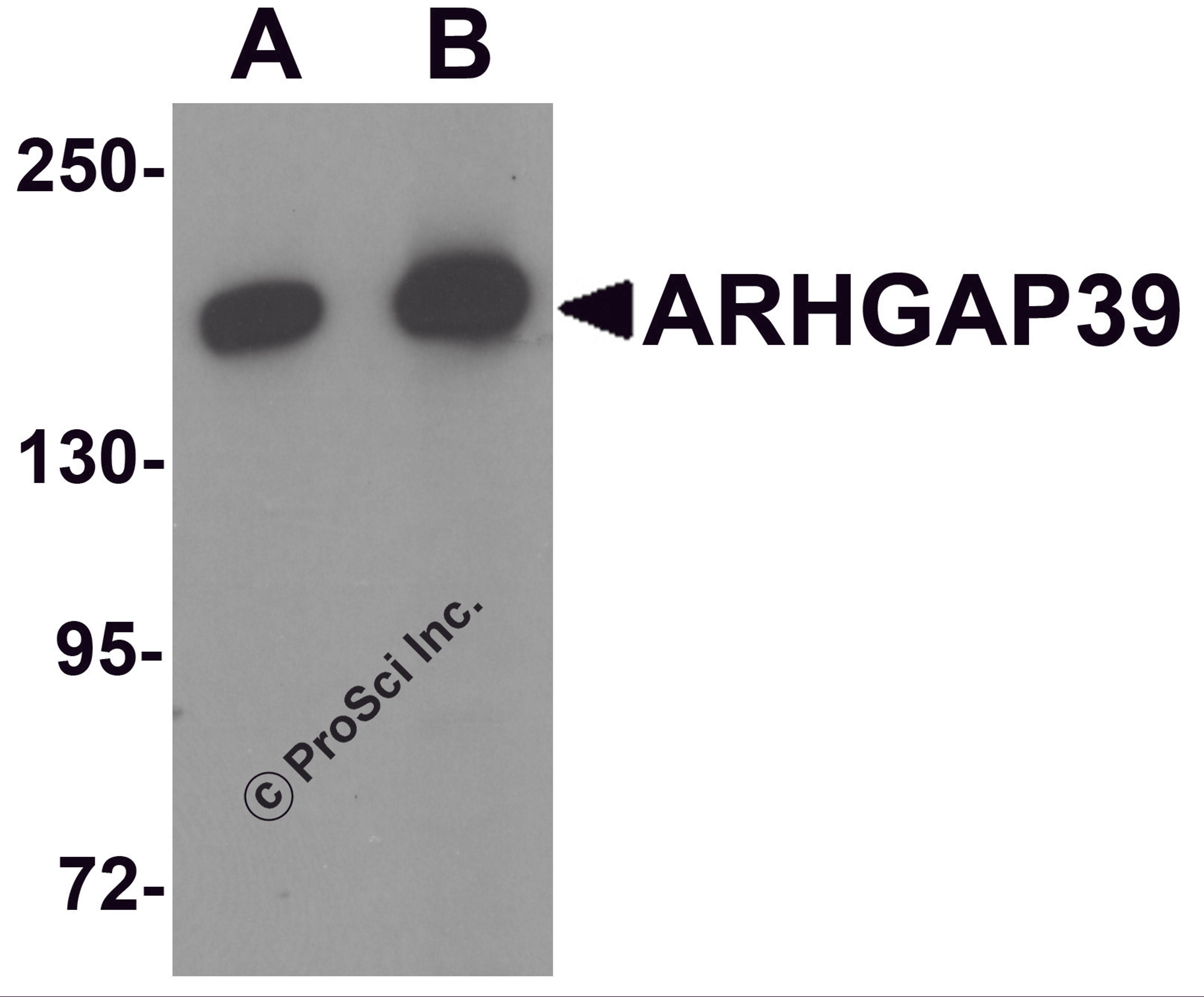 Western blot analysis of ARHGAP39 in A20 cell lysate with ARHGAP39 antibody at (A) 1 and (B) 2 &#956;g/mL