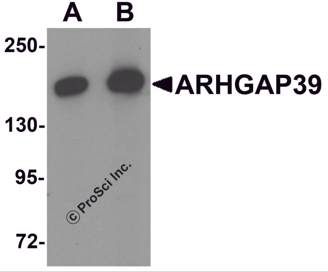 Western blot analysis of ARHGAP39 in A20 cell lysate with ARHGAP39 antibody at (A) 1 and (B) 2 μg/mL