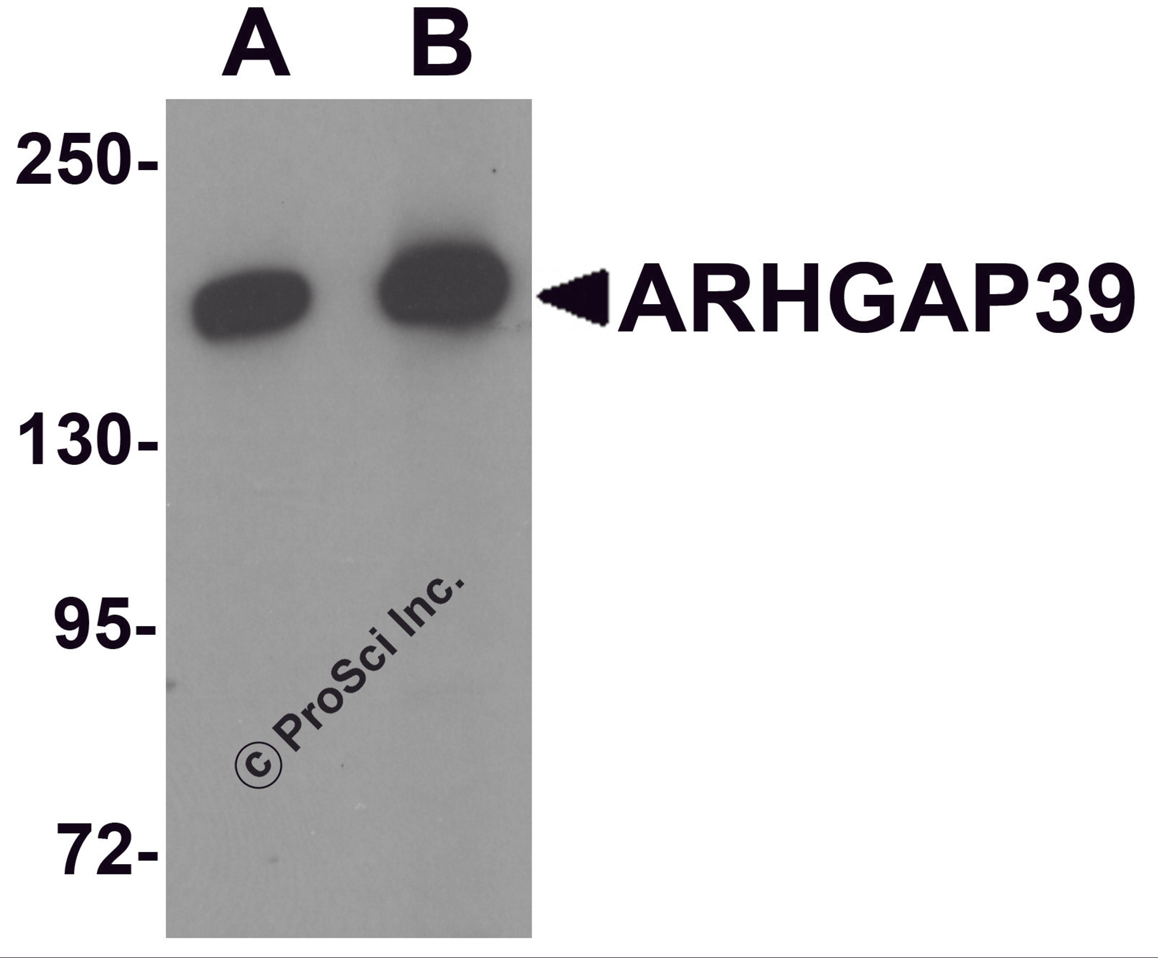 Western blot analysis of ARHGAP39 in A20 cell lysate with ARHGAP39 antibody at (A) 1 and (B) 2 μg/mL