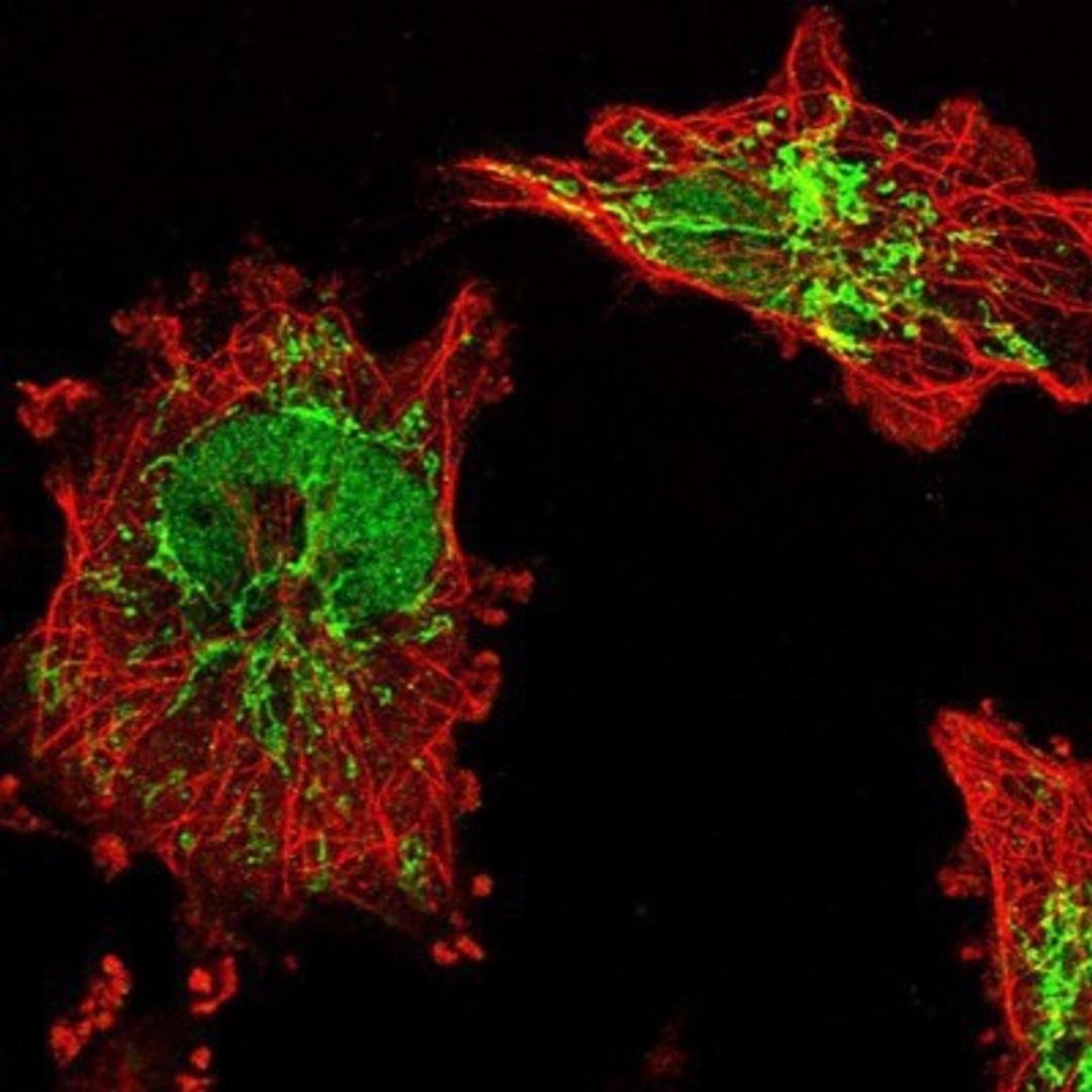 Immunocytochemistry/Immunofluorescence: BDH1 Antibody [NBP1-88673] - Staining of human cell line U-251 MG shows positivity in nucleus but not nucleoli & mitochondria.