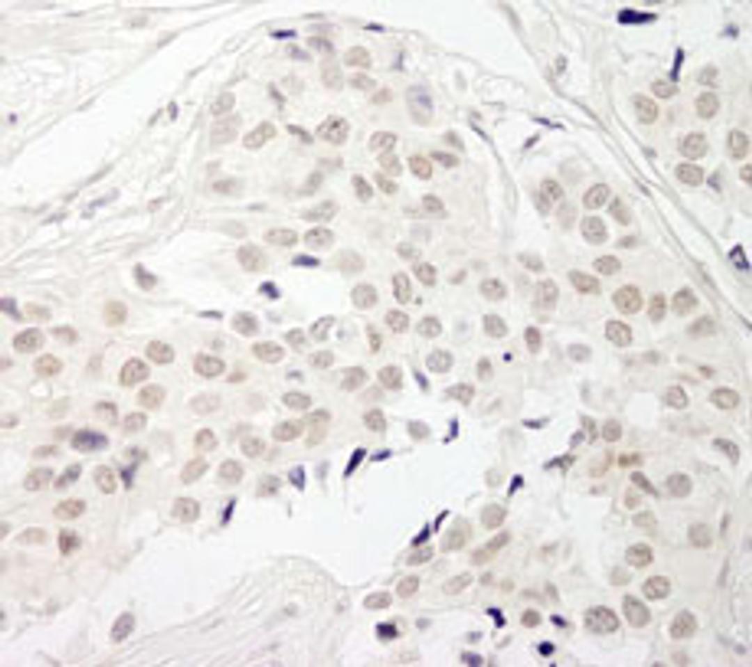 Detection of human PPP1CB by immunohistochemistry.