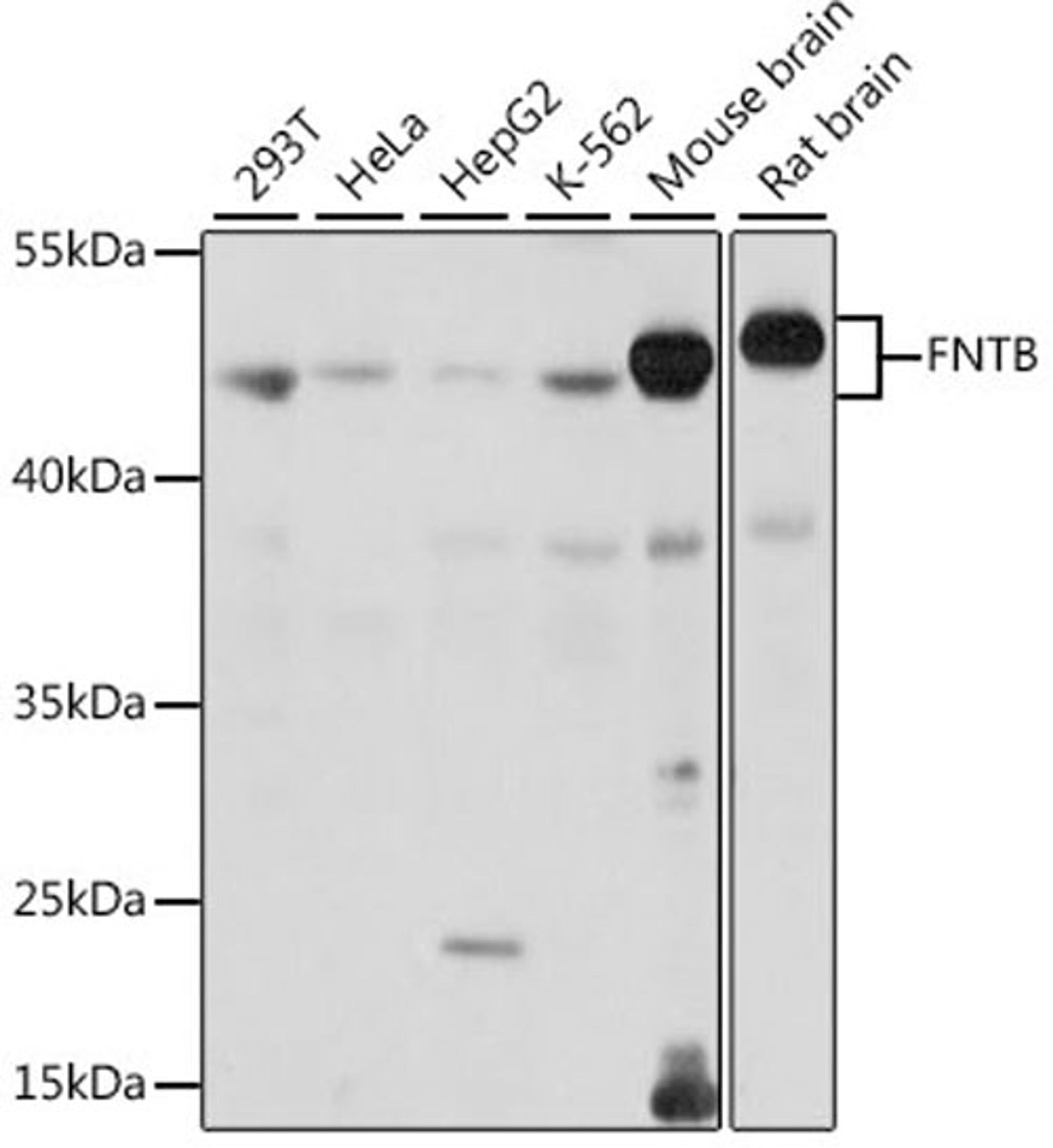 Western blot - FNTB antibody (A15671)