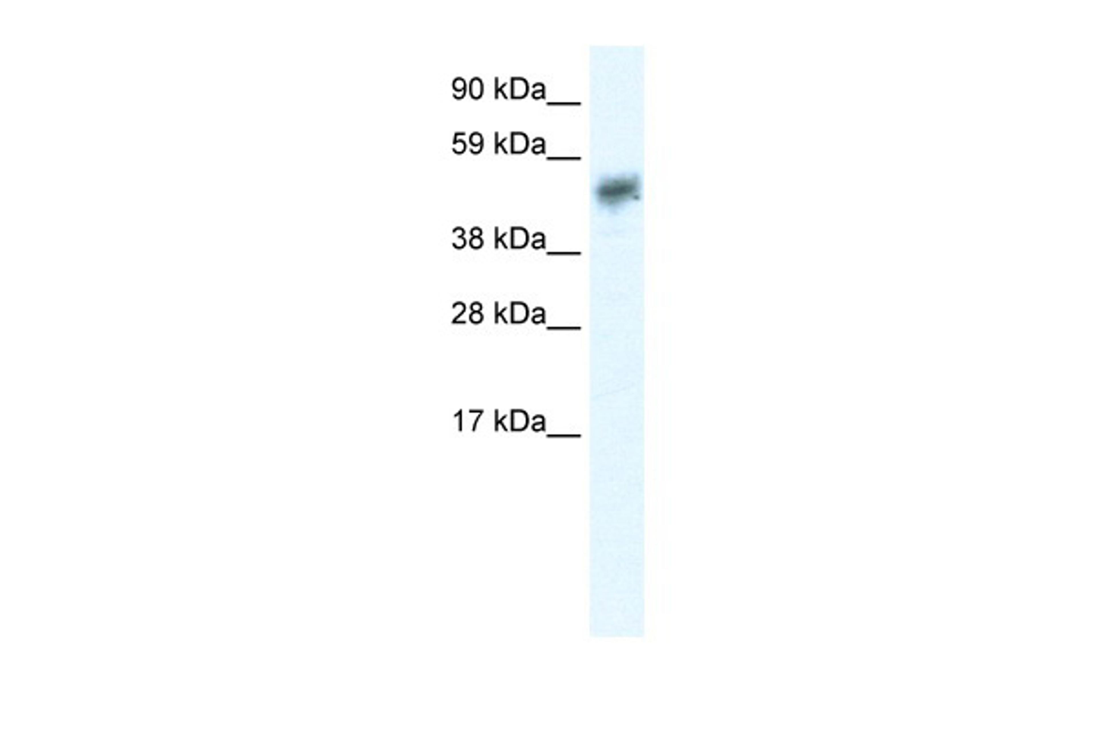 Antibody used in WB on Human Brain at 0.2-1 ug/ml.