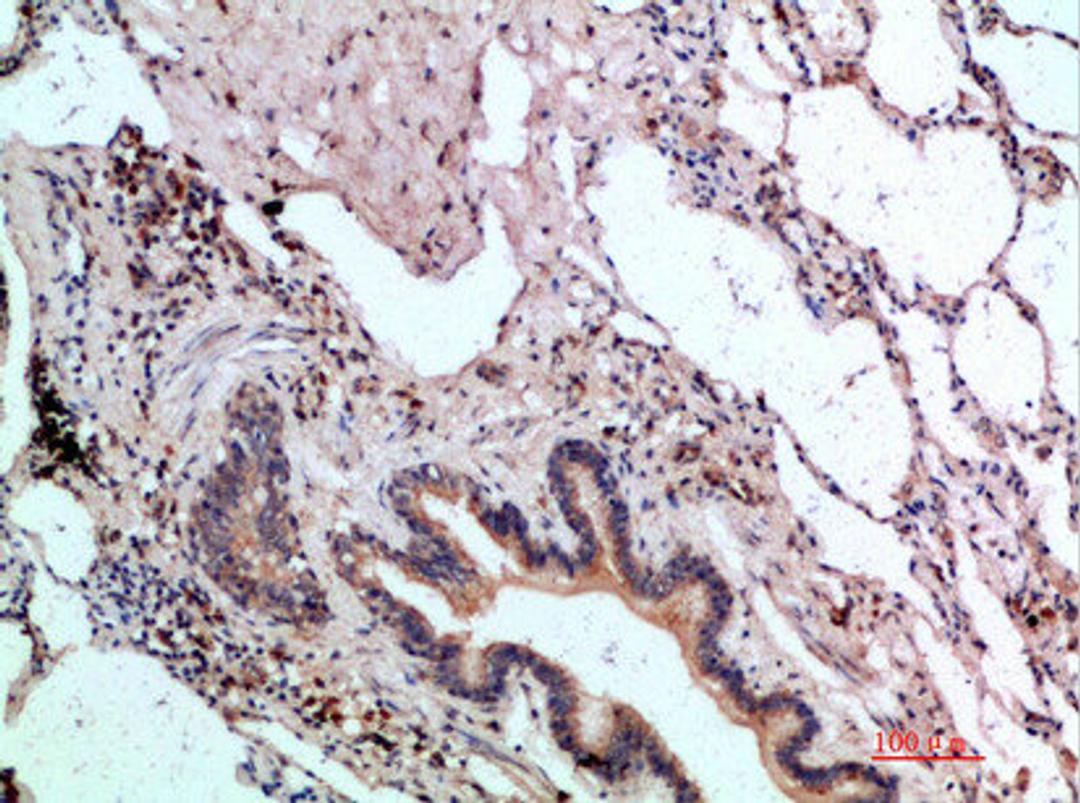 Immunohistochemical analysis of paraffin-embedded human-lung, antibody was diluted at 1:200
