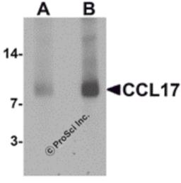 Western blot analysis of CCL17 in rat spleen tissue lysate with CCL17 antibody at (A) 1 and (B) 2 μg/mL