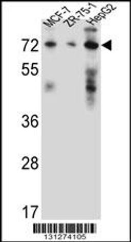 Western blot analysis in MCF-7,ZR-75-1,HepG2 cell line lysates (35ug/lane).