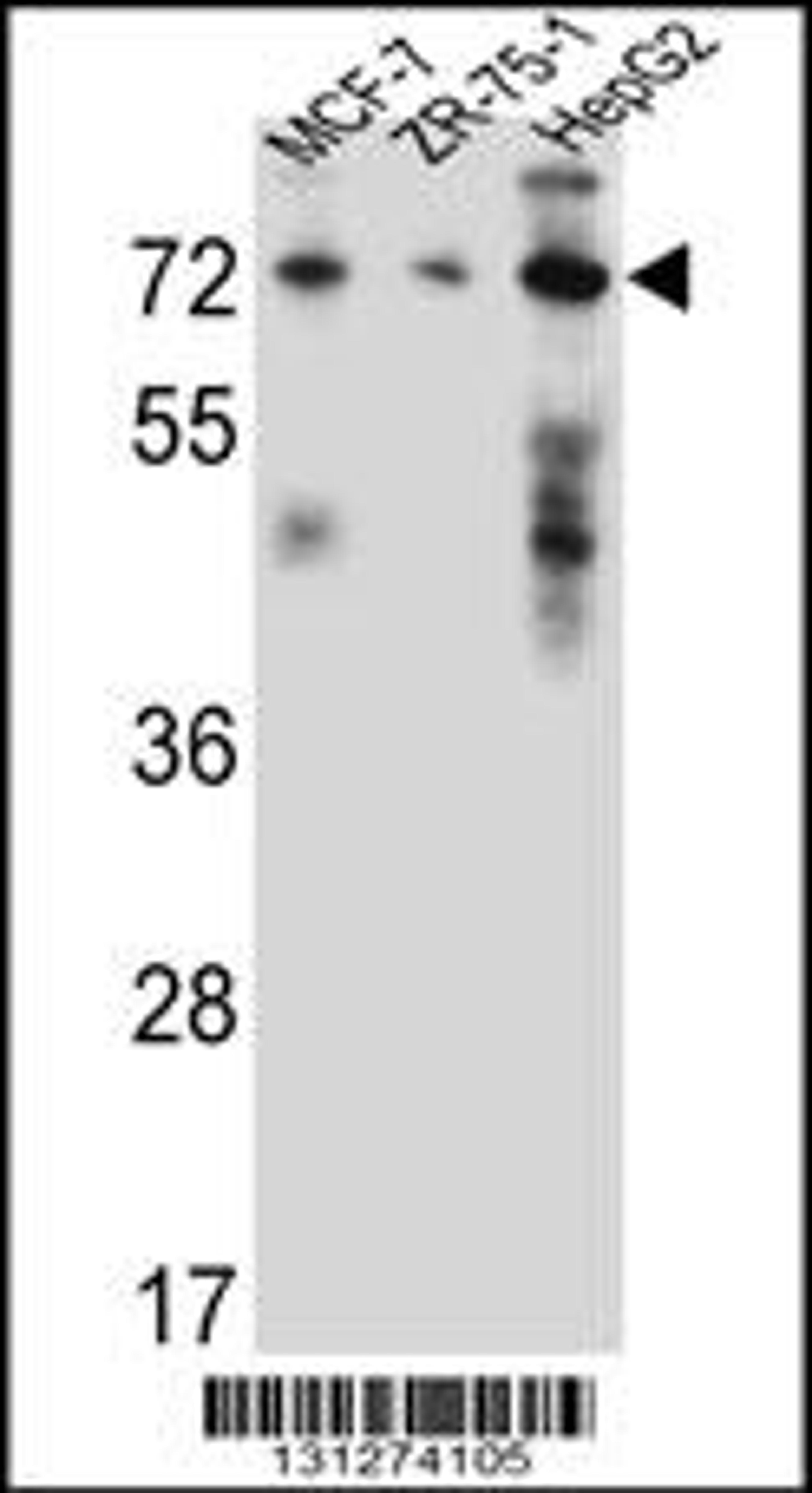 Western blot analysis in MCF-7,ZR-75-1,HepG2 cell line lysates (35ug/lane).