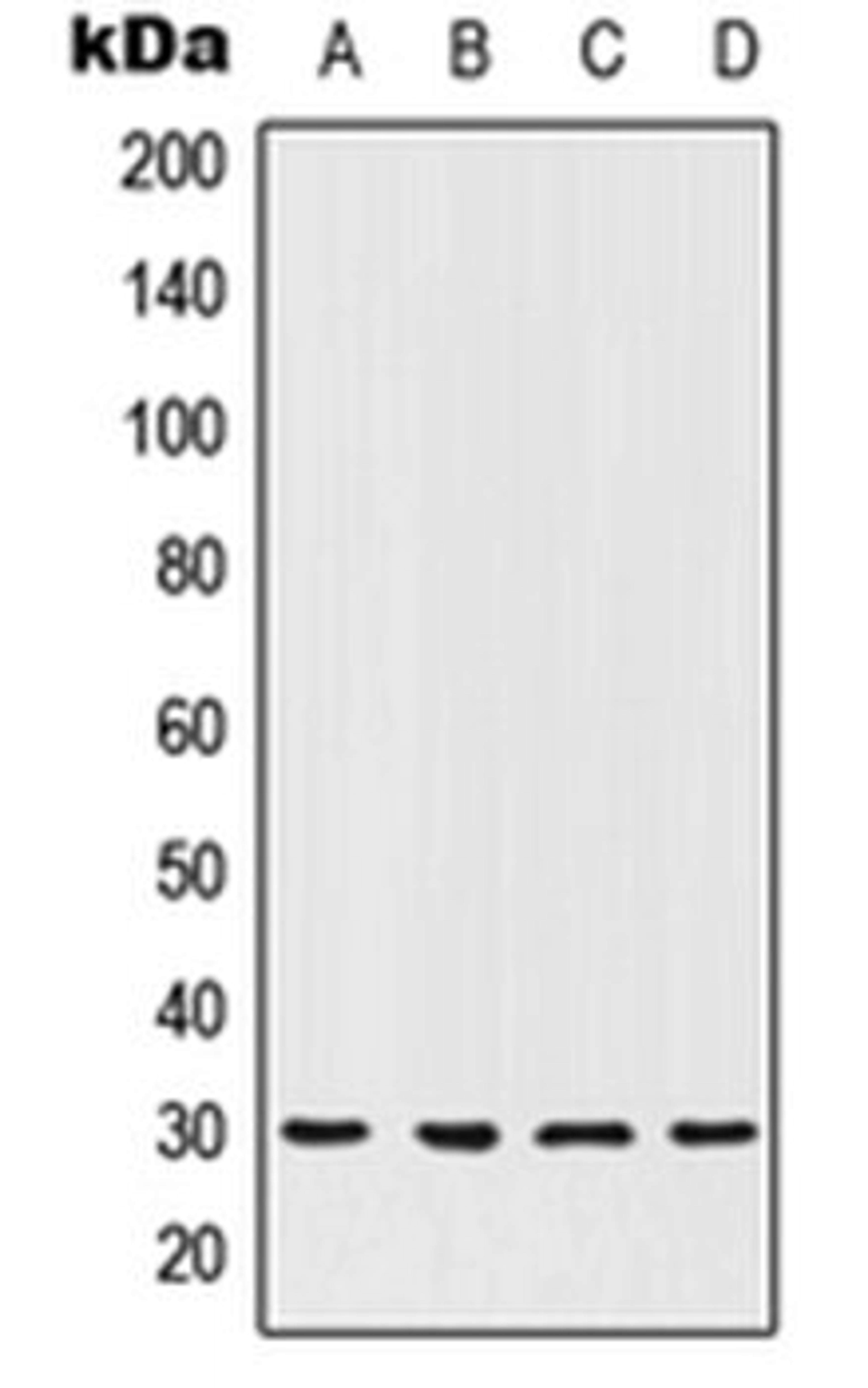 Western blot analysis of MCF7 (Lane 1), ACHN (Lane 2), NIH3T3 (Lane 3), PC12 (Lane 4) whole cell lysates using HOXC12 antibody