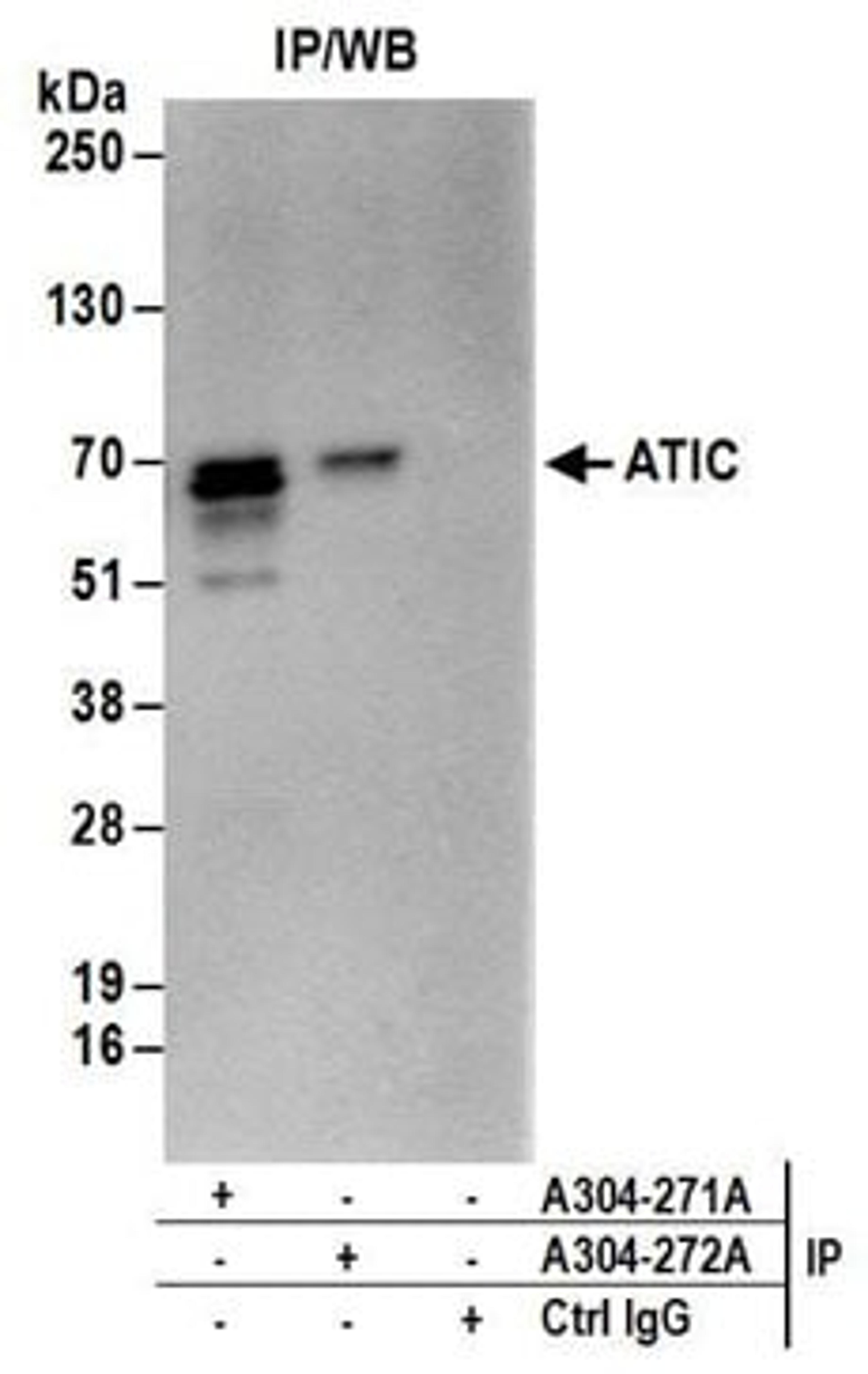 Detection of human ATIC by western blot of immunoprecipitates.