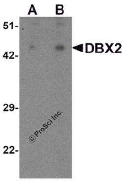 Western blot analysis of WDR18 in rat lung tissue lysate with WDR18 antibody at (A) 1 and (B) 2 μg/mL.