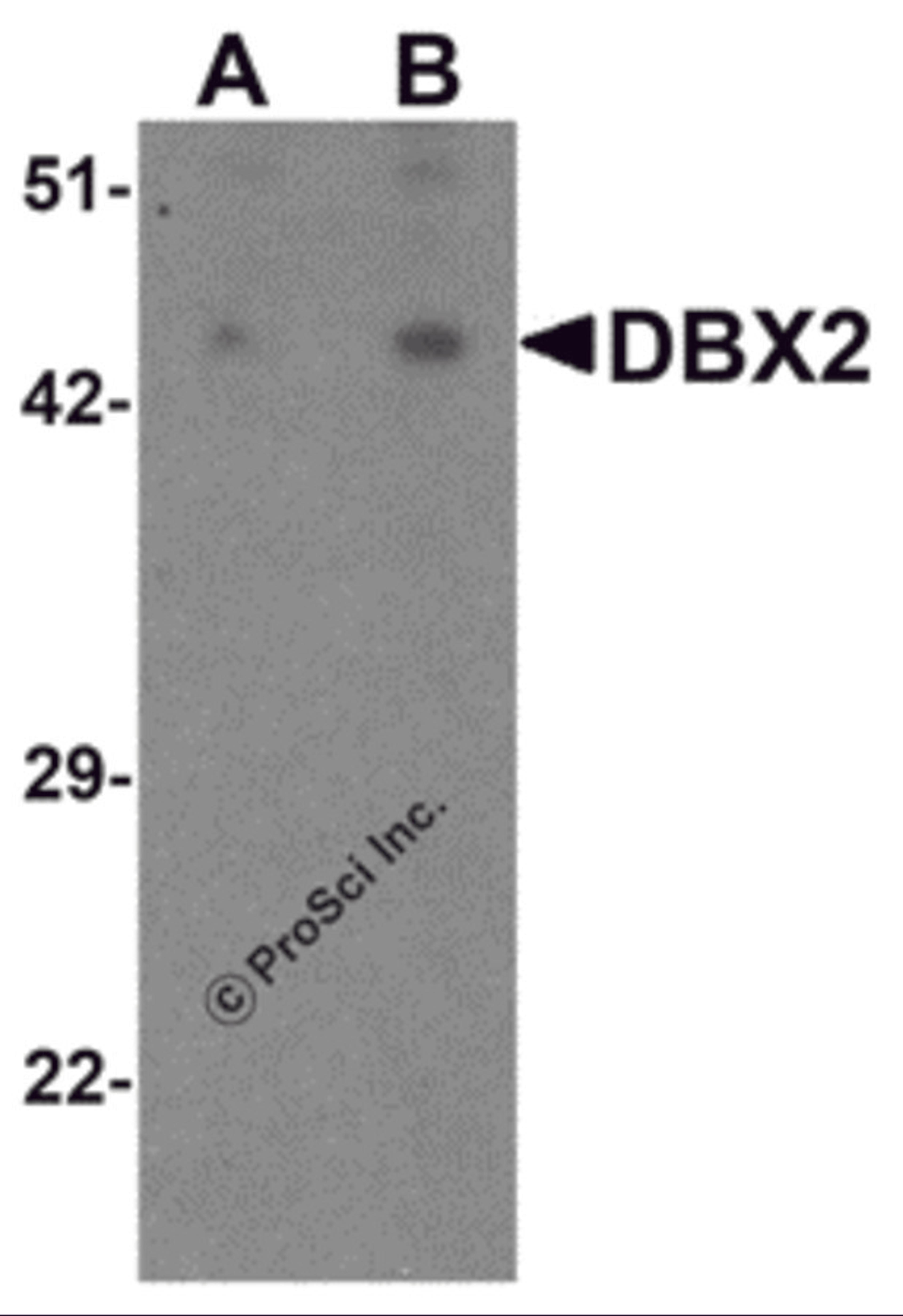 Western blot analysis of WDR18 in rat lung tissue lysate with WDR18 antibody at (A) 1 and (B) 2 μg/mL.
