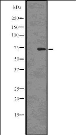 Western blot analysis of COLO205 whole cell lysates using SAMHD1 -Phospho-Thr592- antibody