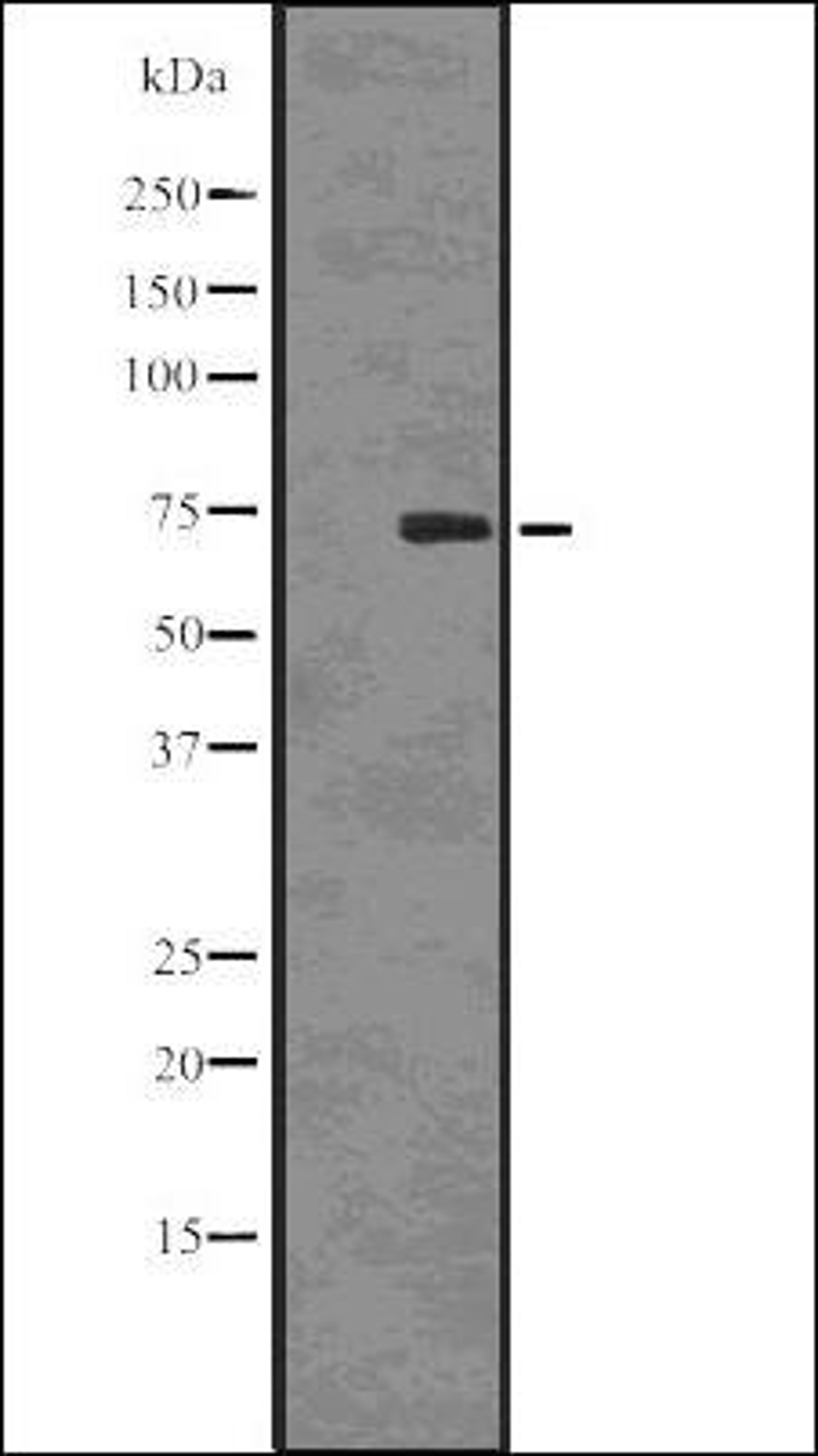 Western blot analysis of COLO205 whole cell lysates using SAMHD1 -Phospho-Thr592- antibody