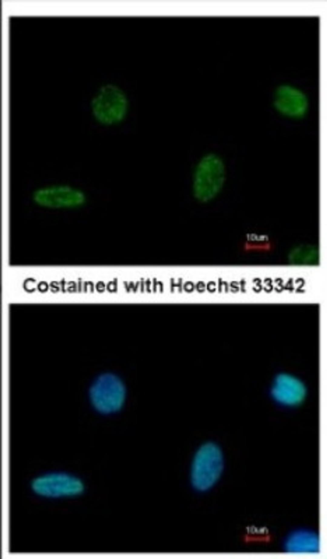 Immunocytochemistry/Immunofluorescence: PGBD1 Antibody [NBP2-19782] - Immunofluorescence analysis of methanol-fixed HeLa, using antibody at 1:500 dilution.