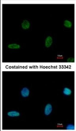 Immunocytochemistry/Immunofluorescence: PGBD1 Antibody [NBP2-19782] - Immunofluorescence analysis of methanol-fixed HeLa, using antibody at 1:500 dilution.