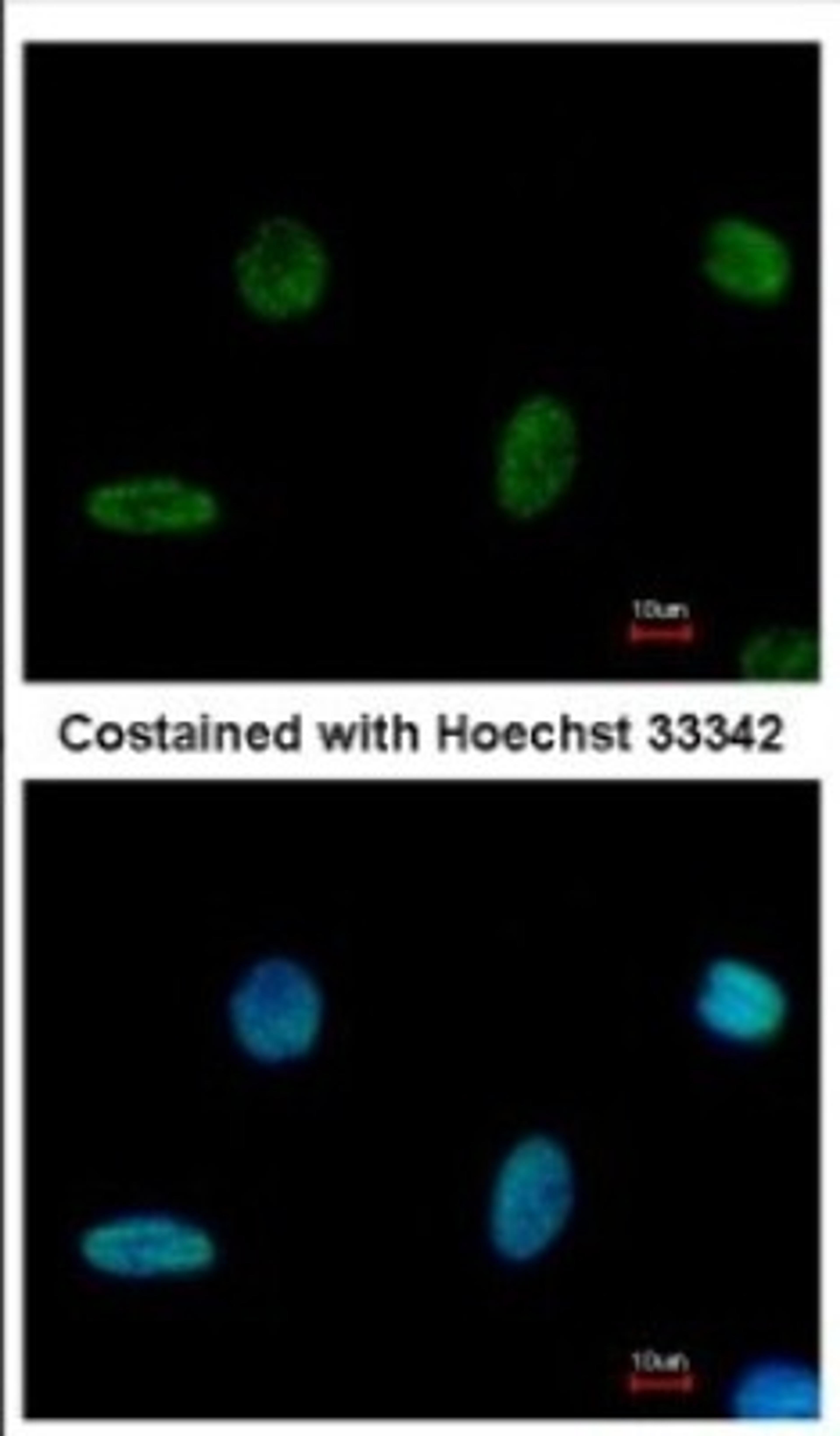 Immunocytochemistry/Immunofluorescence: PGBD1 Antibody [NBP2-19782] - Immunofluorescence analysis of methanol-fixed HeLa, using antibody at 1:500 dilution.