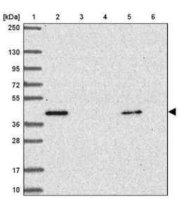 Western Blot: KIR5.1 Antibody [NBP2-34127] - Lane 1: Marker [kDa] 250, 130, 95, 72, 55, 36, 28, 17, 10<br/>Lane 2: Human cell line RT-4<br/>Lane 3: Human cell line U-251MG sp<br/>Lane 4: Human plasma (IgG/HSA depleted)<br/>Lane 5: Human liver tissue<br/>Lane 6: Human tonsil tissue