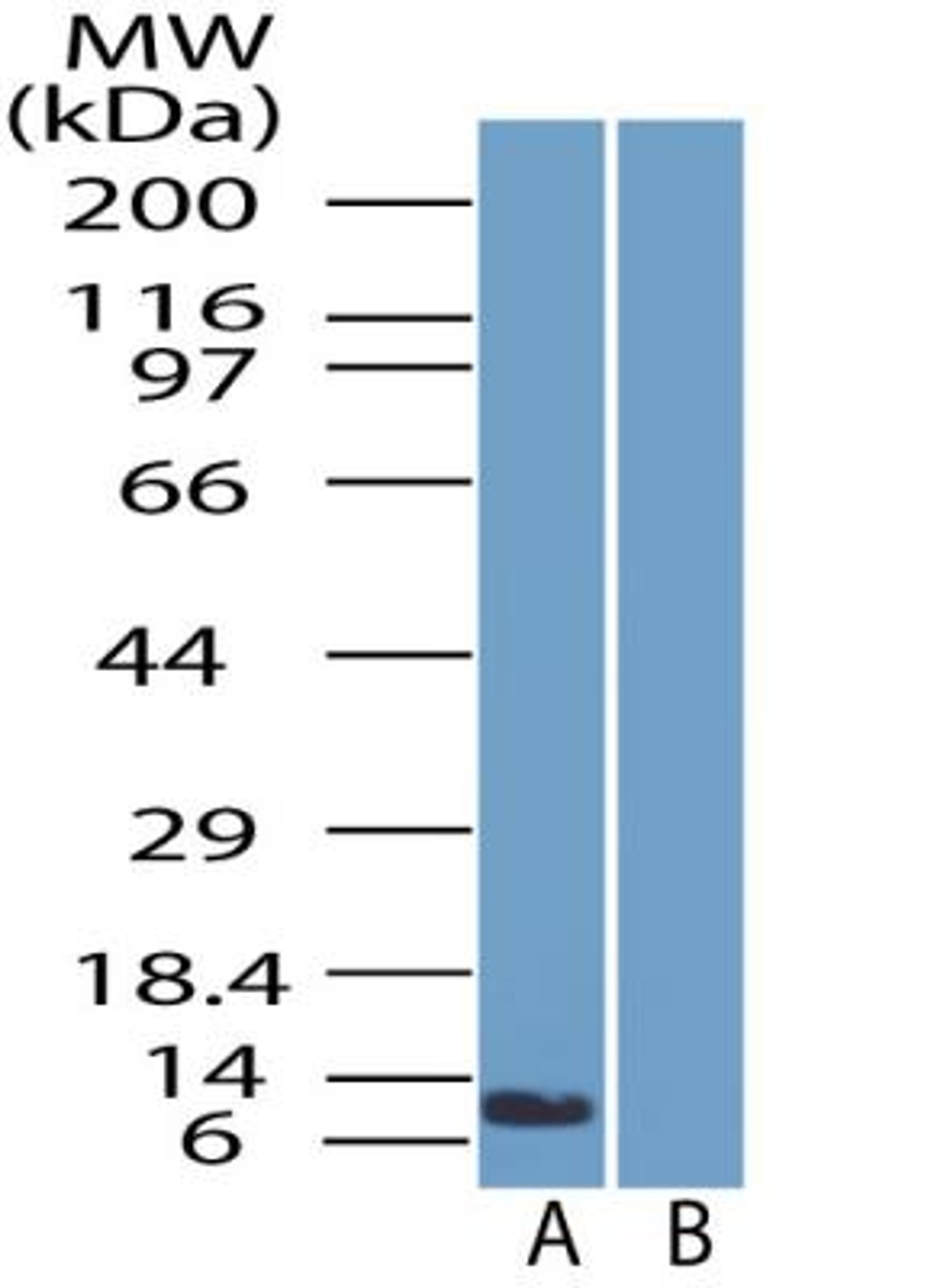 Western Blot: SPINK1 Antibody [NBP2-29620] - Western blot analysis of SPINK1 in PANC-1 cell lysate in the A) absence and B) presence of immunizing peptide.