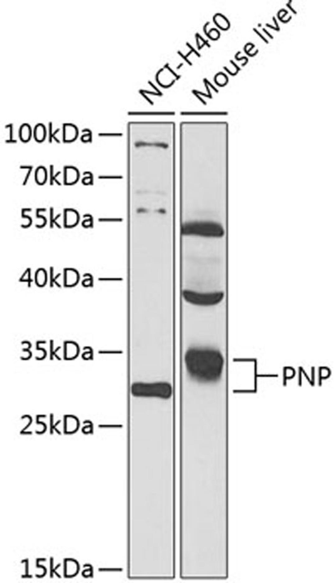 Western blot - PNP antibody (A14032)