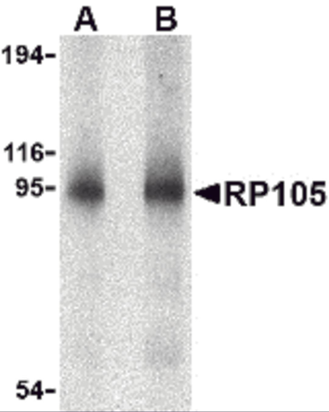 Western blot analysis of RP105 in human spleen tissue lysate with RP105 antibody at (A) 0.5 and (B) 1 μg/mL.