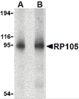 Western blot analysis of RP105 in human spleen tissue lysate with RP105 antibody at (A) 0.5 and (B) 1 μg/mL.