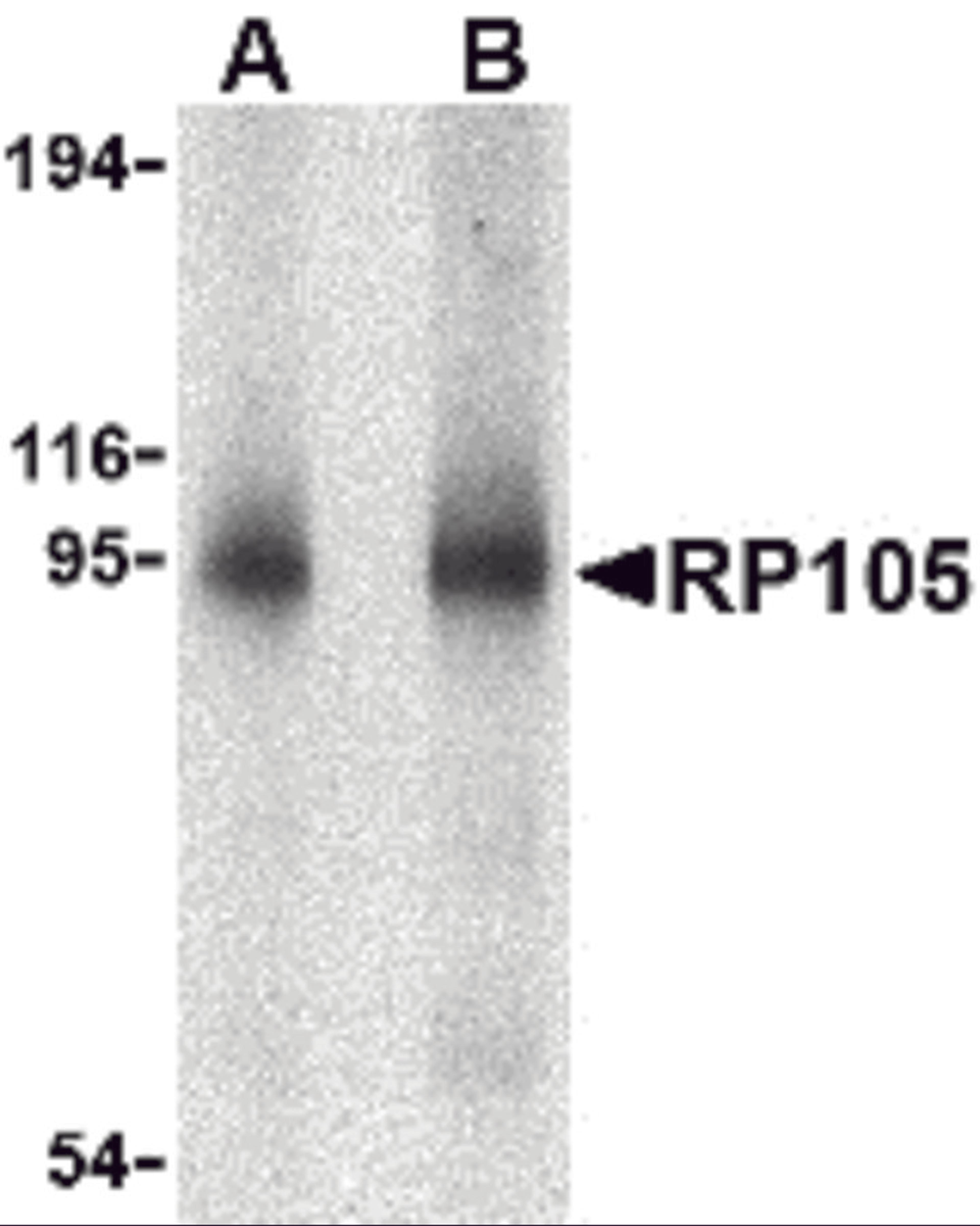 Western blot analysis of RP105 in human spleen tissue lysate with RP105 antibody at (A) 0.5 and (B) 1 μg/mL.