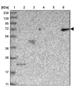 Western Blot: CCDC30 Antibody [NBP1-93963] - Lane 1: Marker [kDa] 230, 130, 95, 72, 56, 36, 28, 17, 11<br/>Lane 2: Human cell line RT-4<br/>Lane 3: Human cell line U-251MG sp<br/>Lane 4: Human plasma (IgG/HSA depleted)<br/>Lane 5: Human liver tissue<br/>Lane 6: Human tonsil tissue